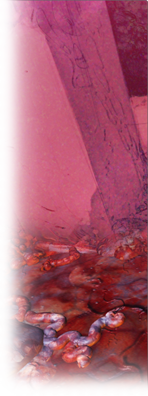 left